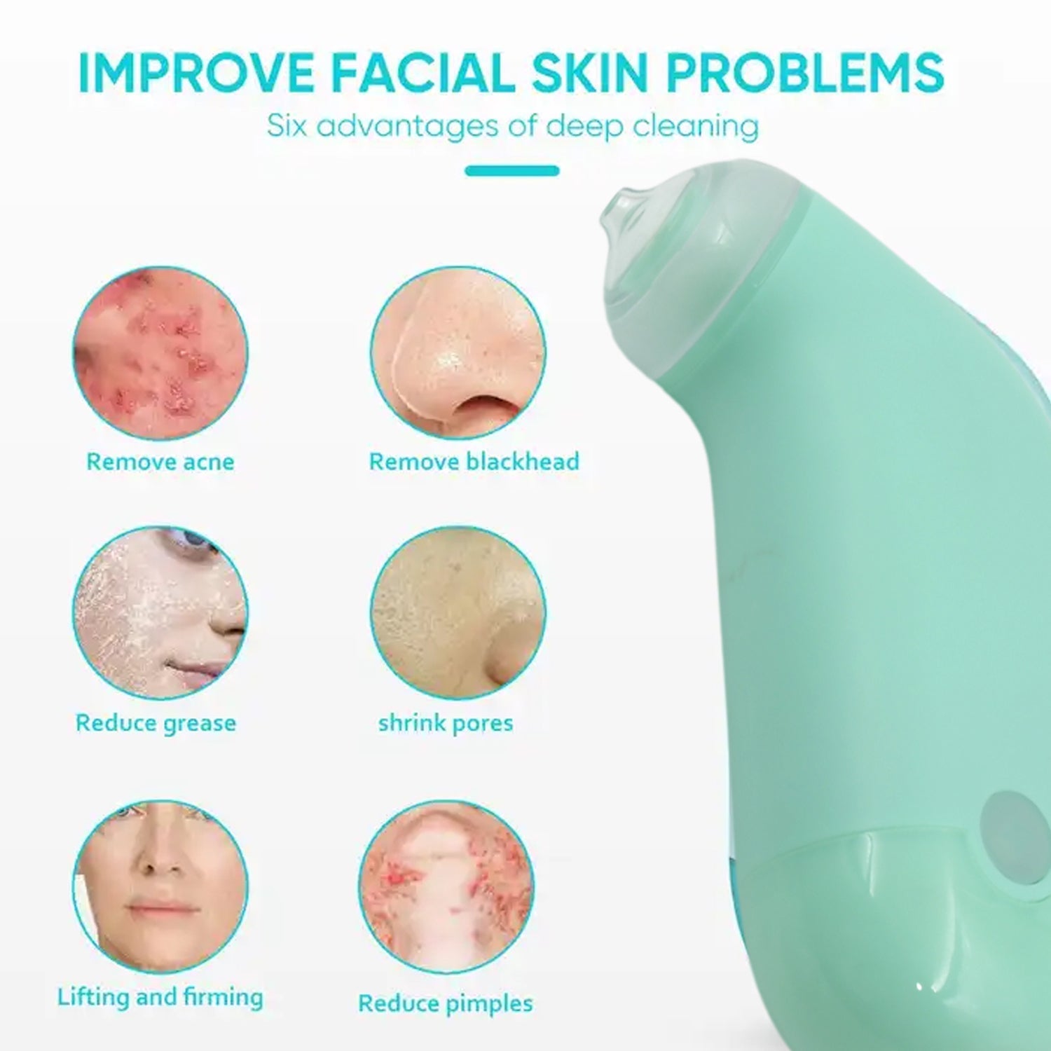 Mini Handheld Vacuum Blackhead Remover – Facial Massage & Spot Lifting (1 Pc) Variety Bazaar