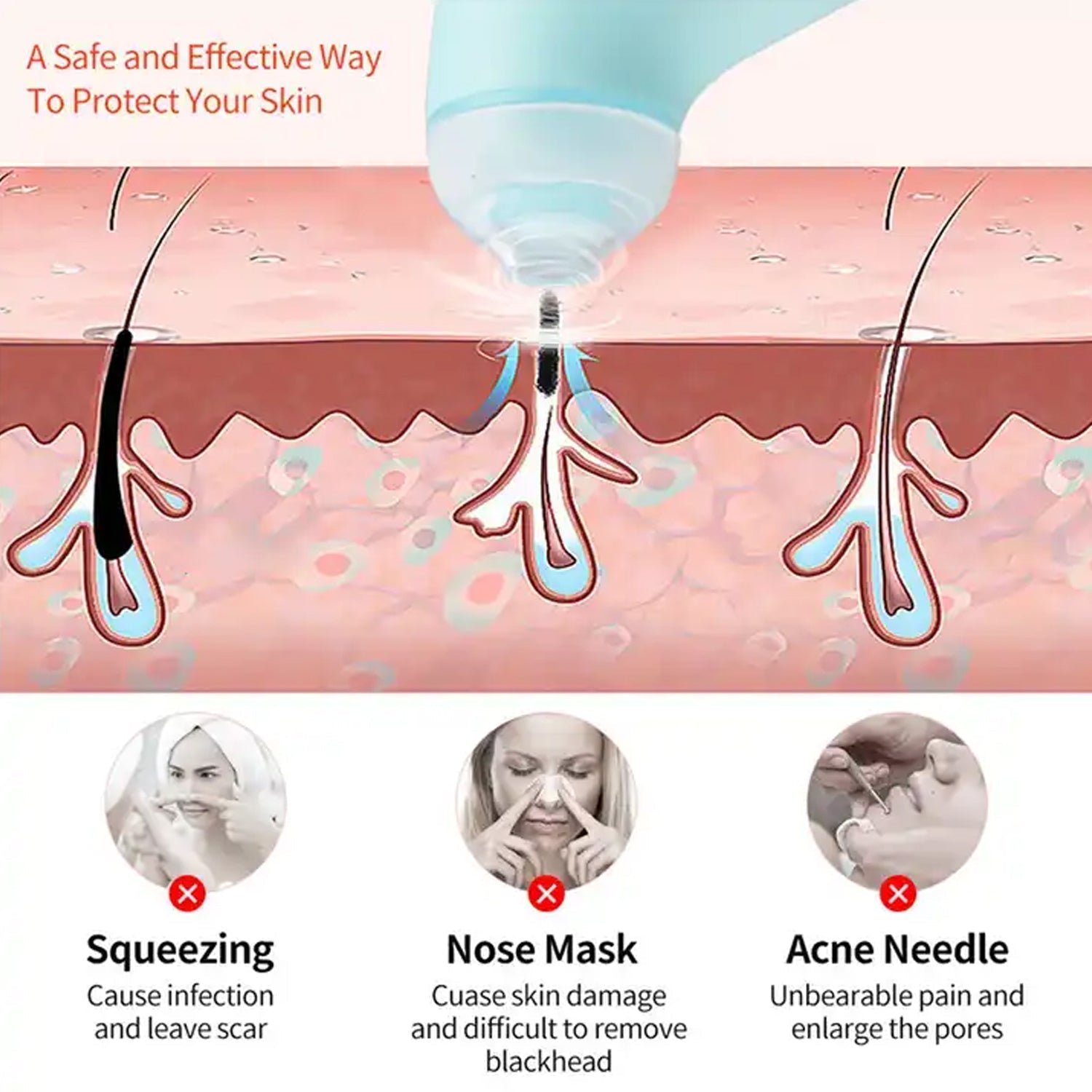 Mini Handheld Vacuum Blackhead Remover – Facial Massage & Spot Lifting (1 Pc) Variety Bazaar