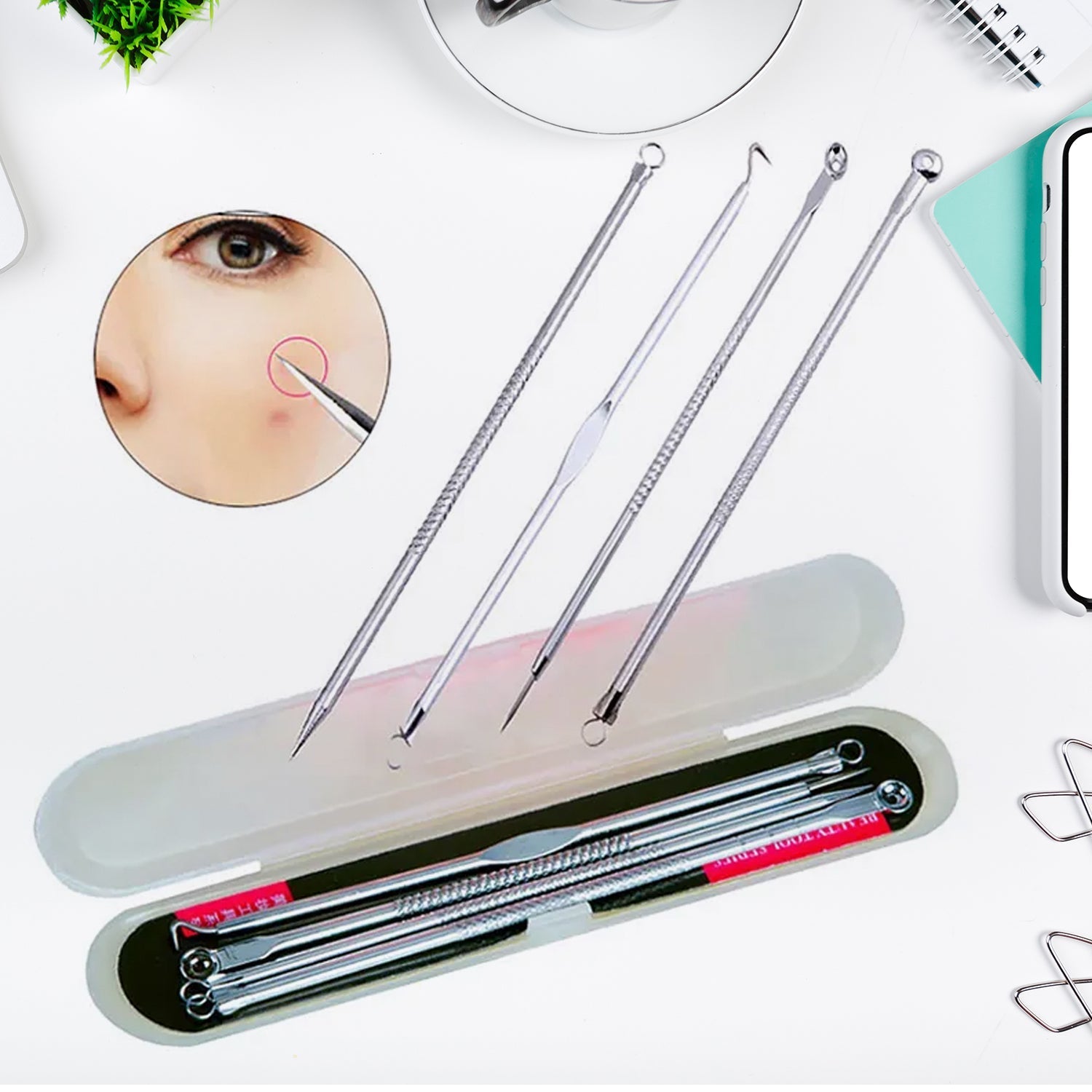 Blackhead Remover, 4-in-1 Stainless Steel Pimple Extractor Tool (1 Pc) Variety Bazaar