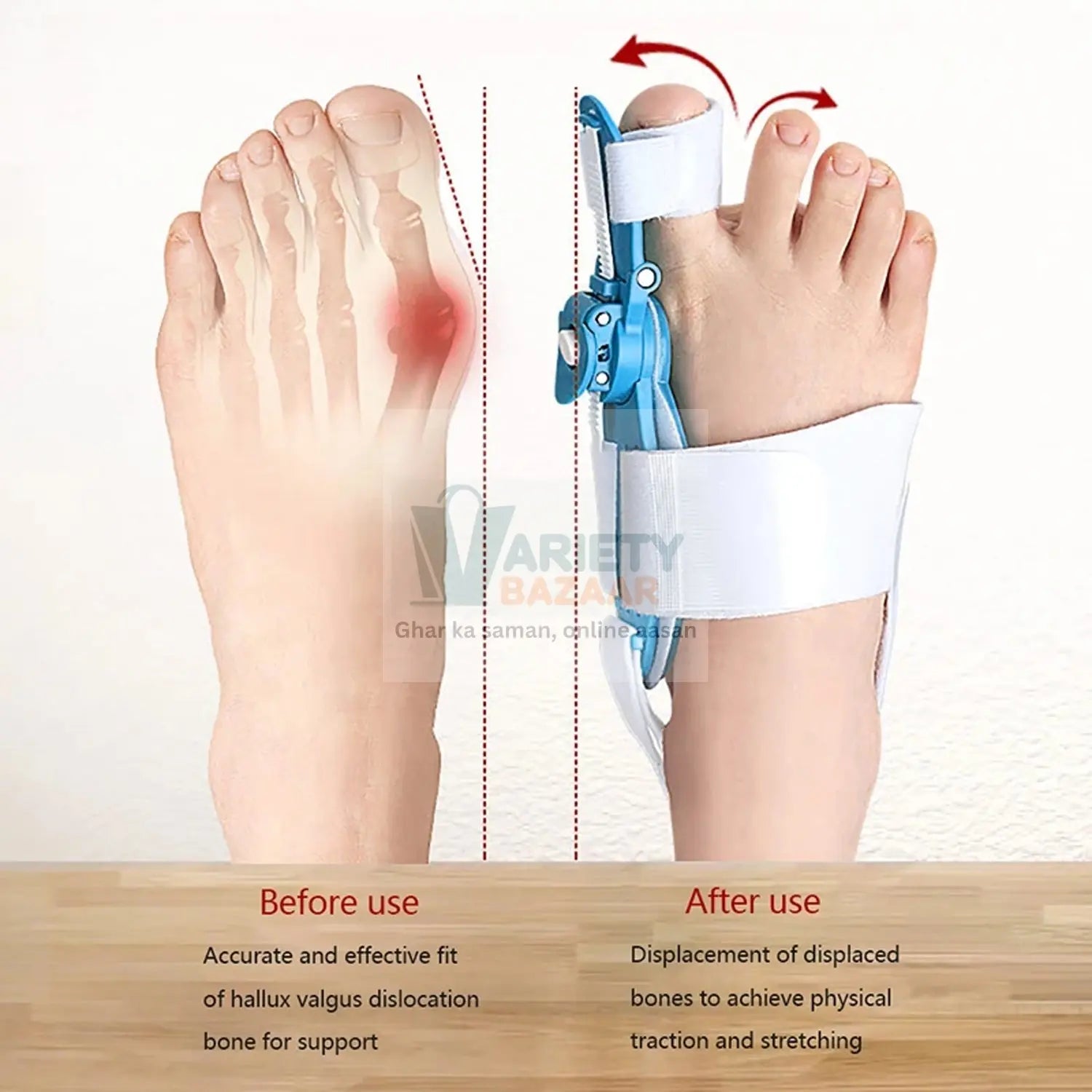 Adjustable Bunion Support Splint – Hallux Valgus Corrector for Men & Women Variety Bazaar