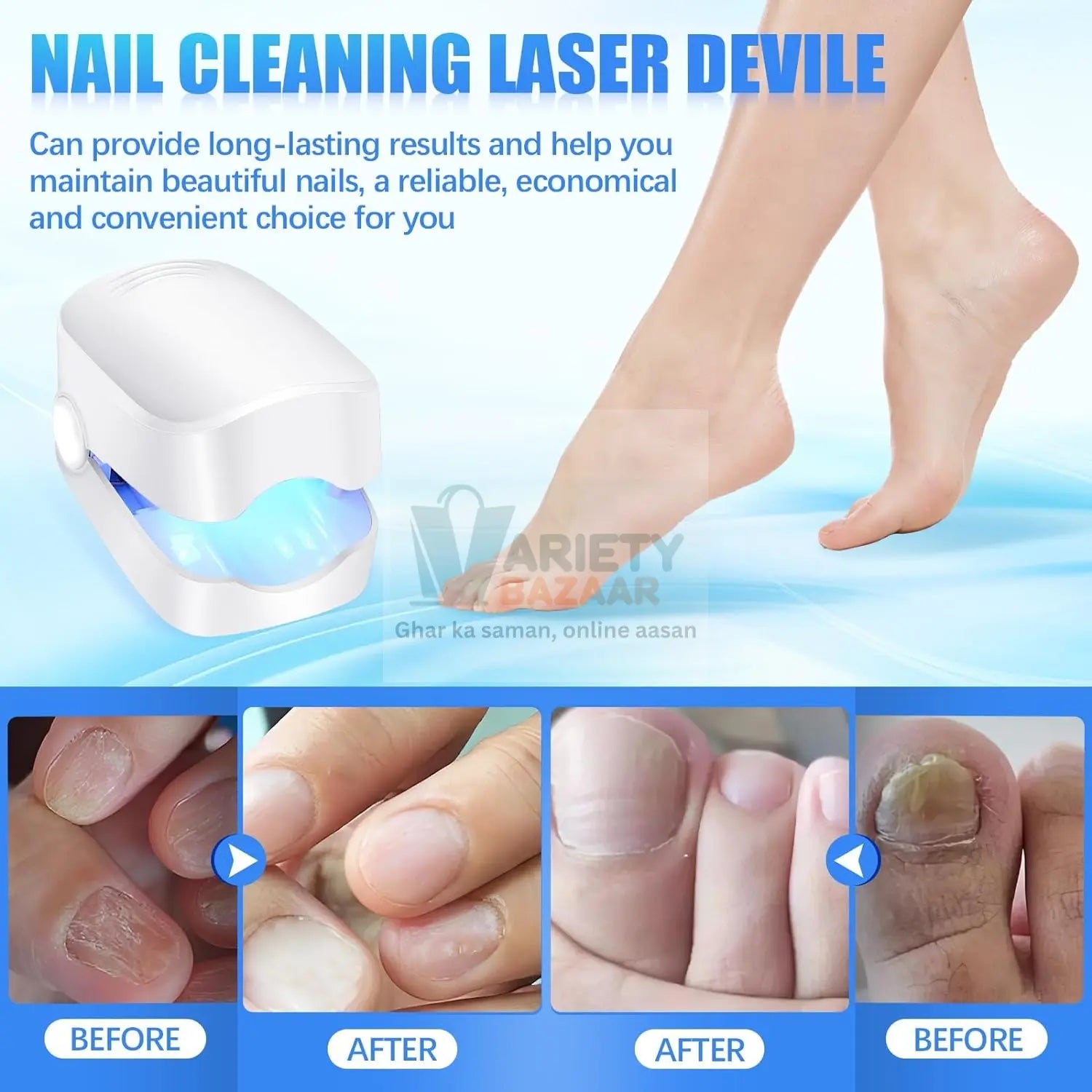 Rechargeable Nail Fungus Laser – Anti-Fungal Device for Toenails, Hands & Feet (Home Use) Variety Bazaar