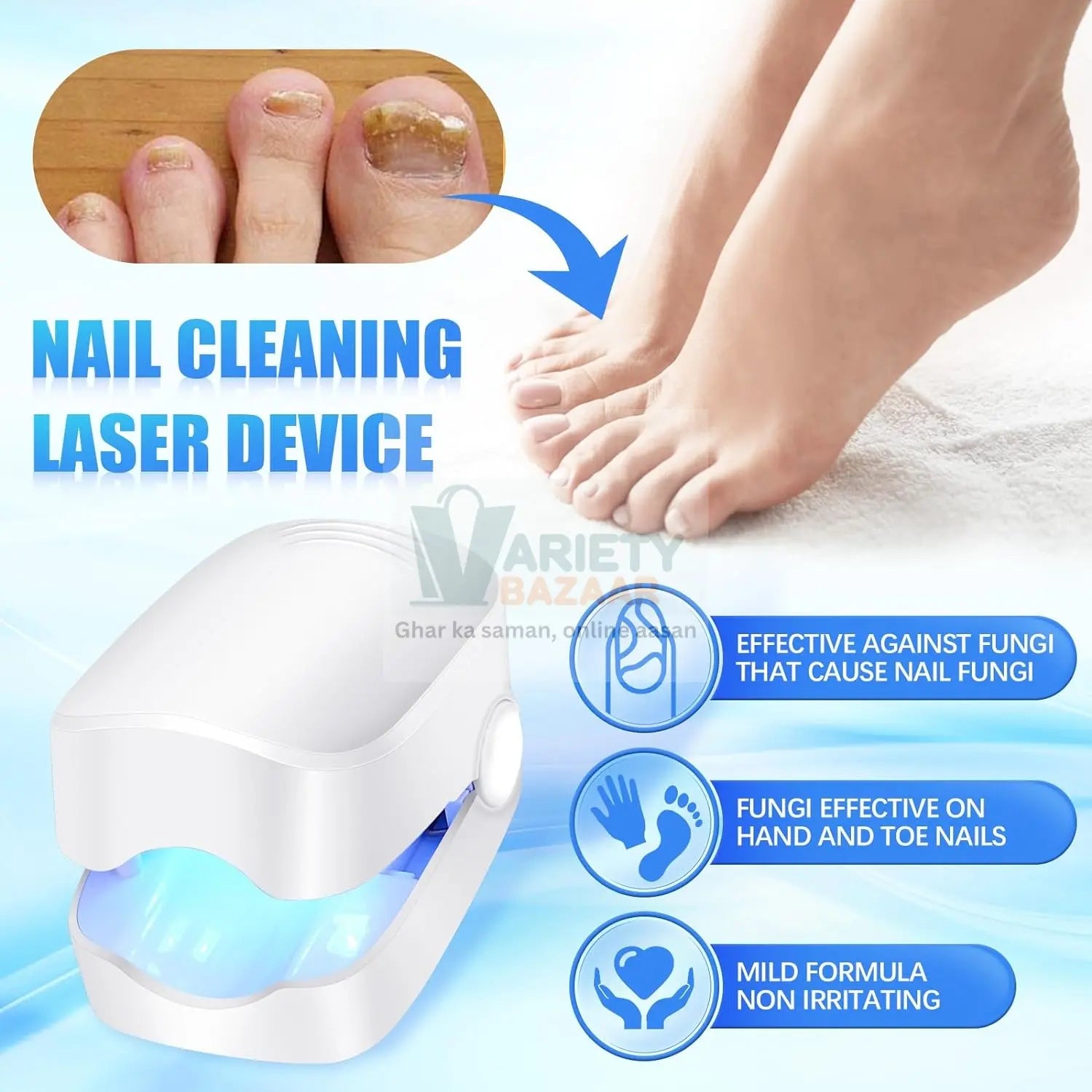 Rechargeable Nail Fungus Laser – Anti-Fungal Device for Toenails, Hands & Feet (Home Use) Variety Bazaar
