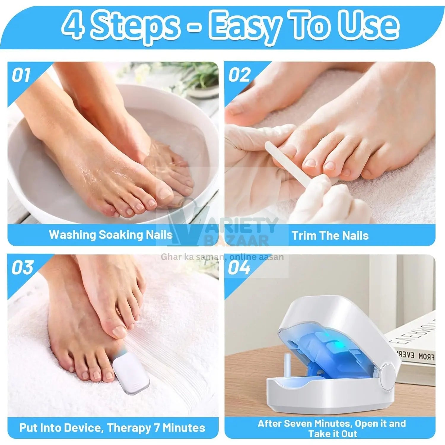 Rechargeable Nail Fungus Laser – Anti-Fungal Device for Toenails, Hands & Feet (Home Use) Variety Bazaar