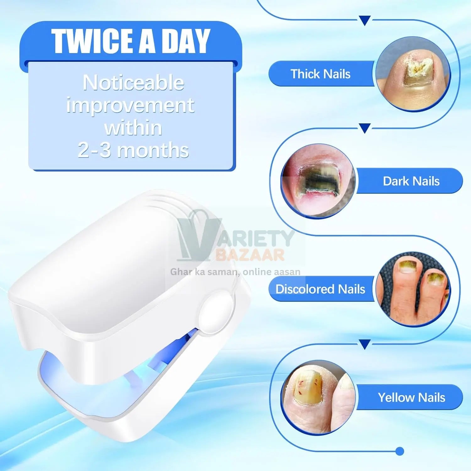 Rechargeable Nail Fungus Laser – Anti-Fungal Device for Toenails, Hands & Feet (Home Use) Variety Bazaar